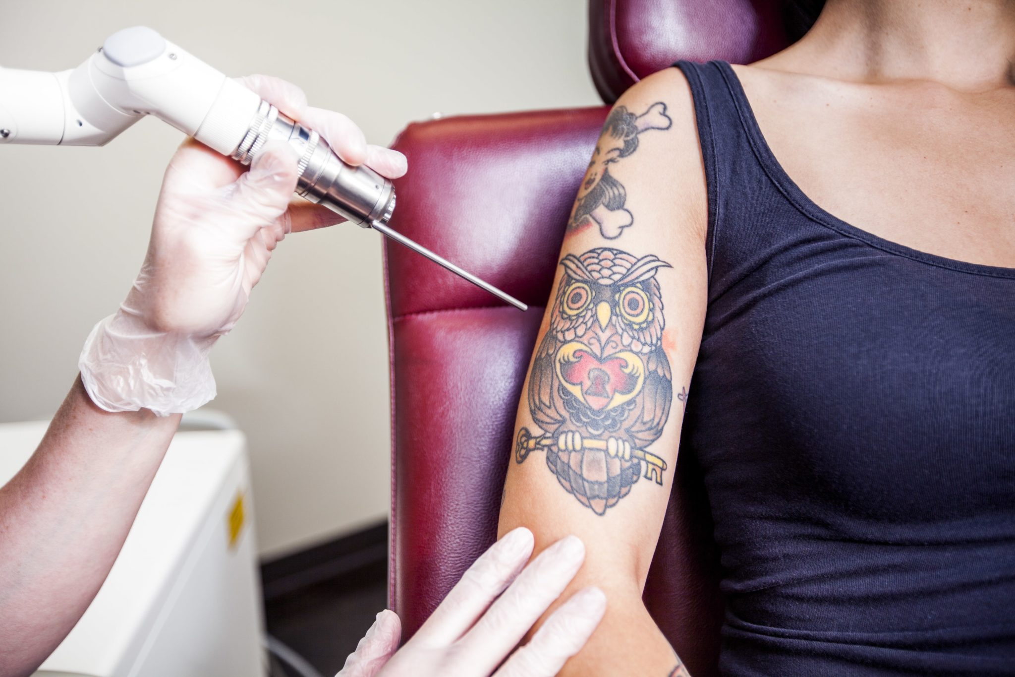 Laser Tattoo Removal Sessions  VGmedispa  Groupon